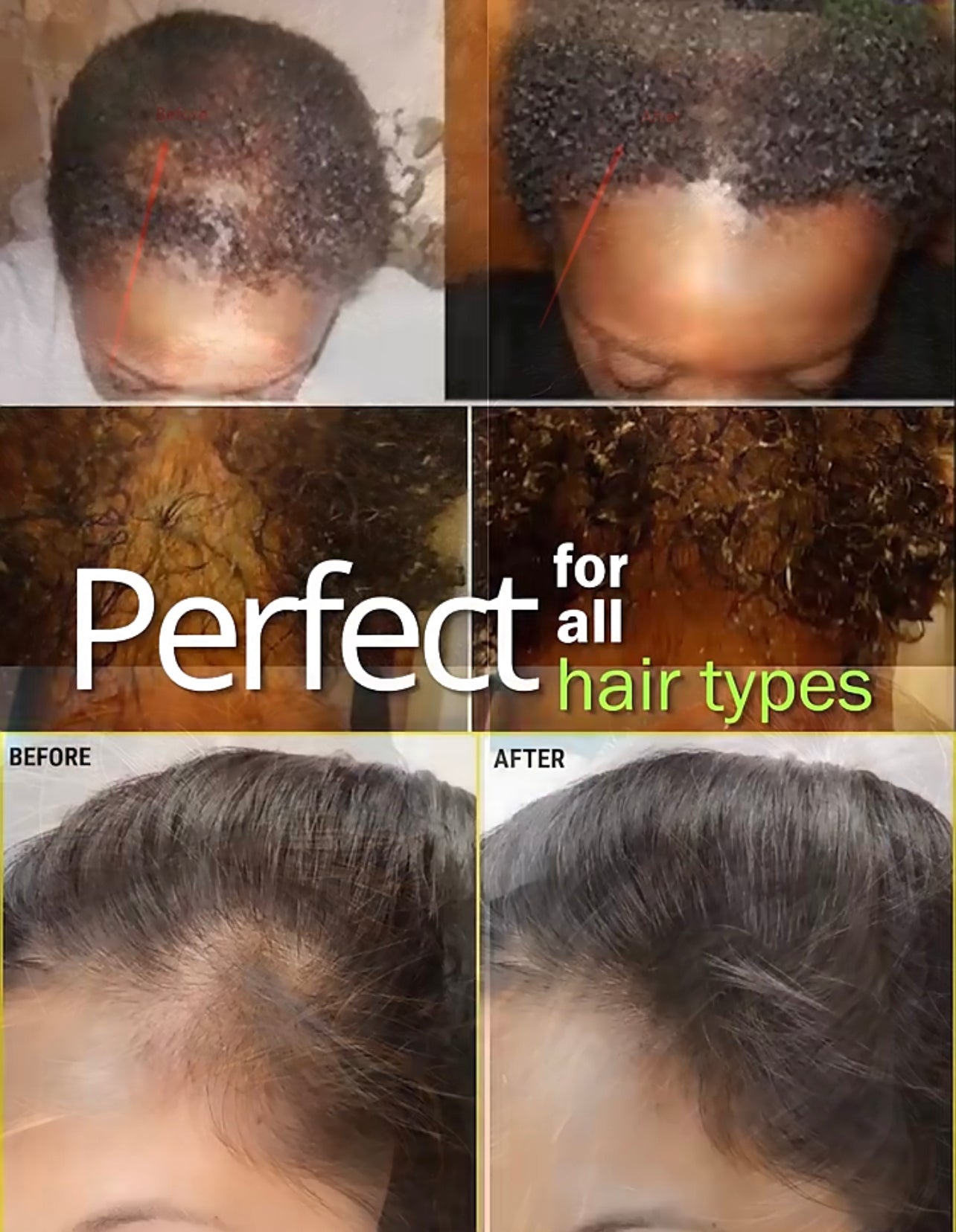 Hair Growth Elixir - Miracle Oil - 60ml